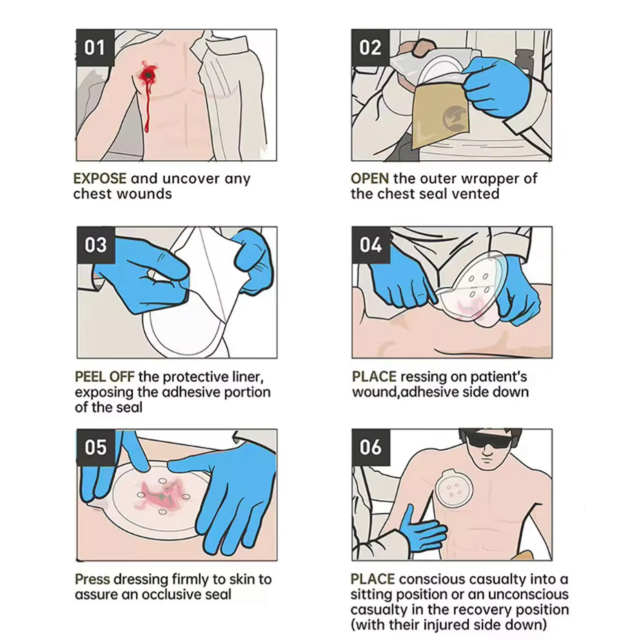 A chest seal is indicated when a patient has penetrating chest trauma from neck to navel, on the front, side or back of the chest. The chest seal doesn't control bleeding inside the chest cavity. Instead, the chest seal prevents air from entering the chest cavity. www.defenceqstore.com.au